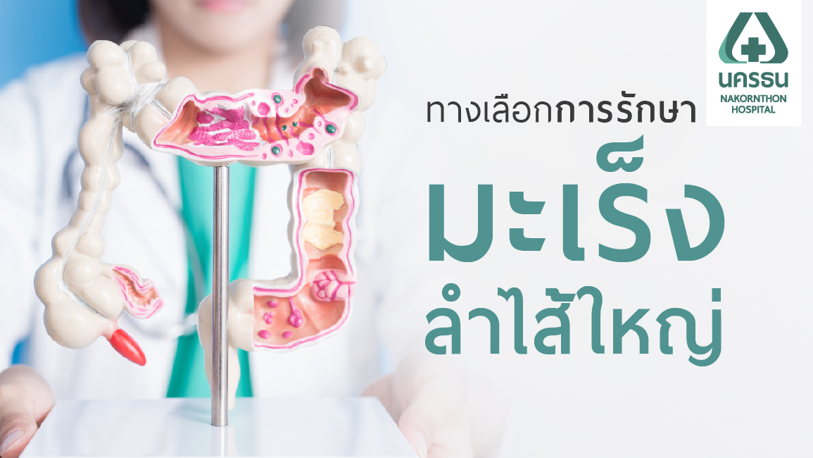 แนวทางการรักษามะเร็งลำไส้ใหญ่